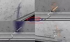 enjeksiyon uygulamalari 17